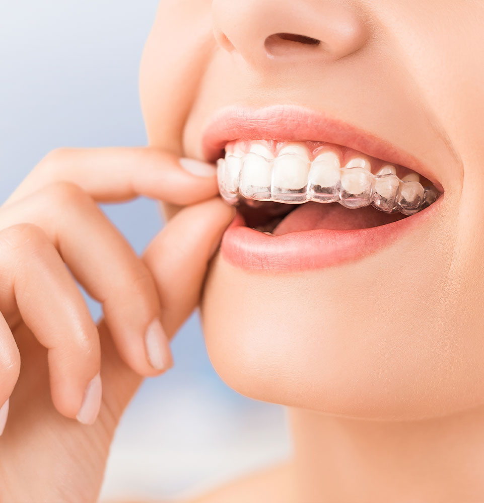 Beautiful smile and white teeth of a young woman.