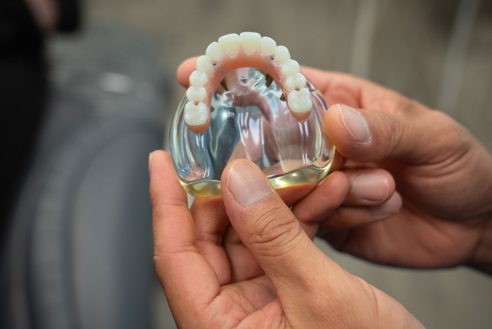 close up of full arch dental implant model