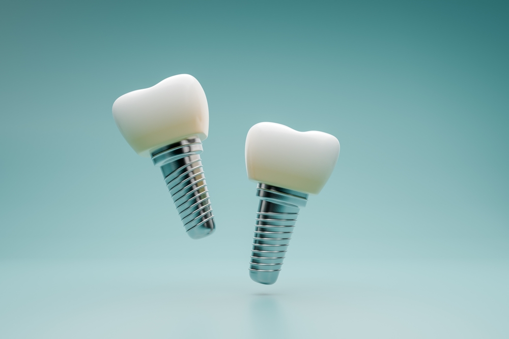 Dentist consulting with a patient about dental implants in a modern office